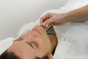 Acupuntura Facial