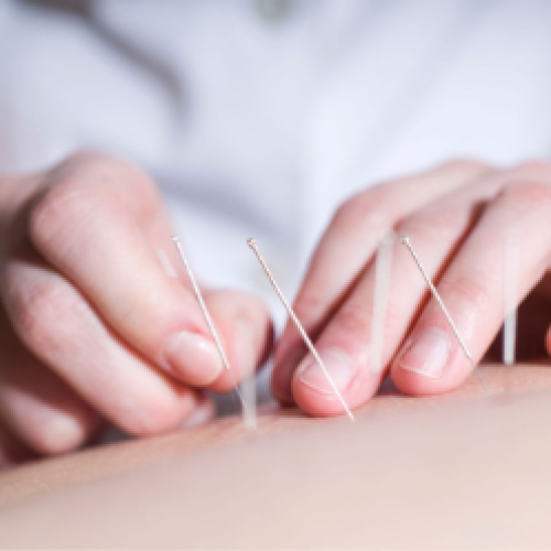 Acupuntura: qué dice la evidencia